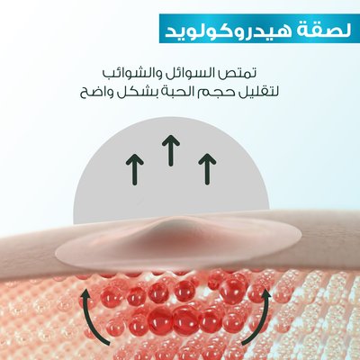 Pimple Patch Benefits