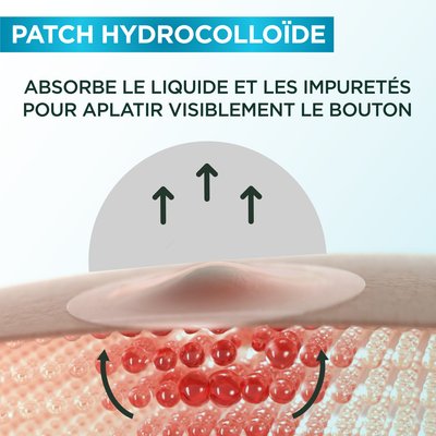 Pimple Patch Benefits