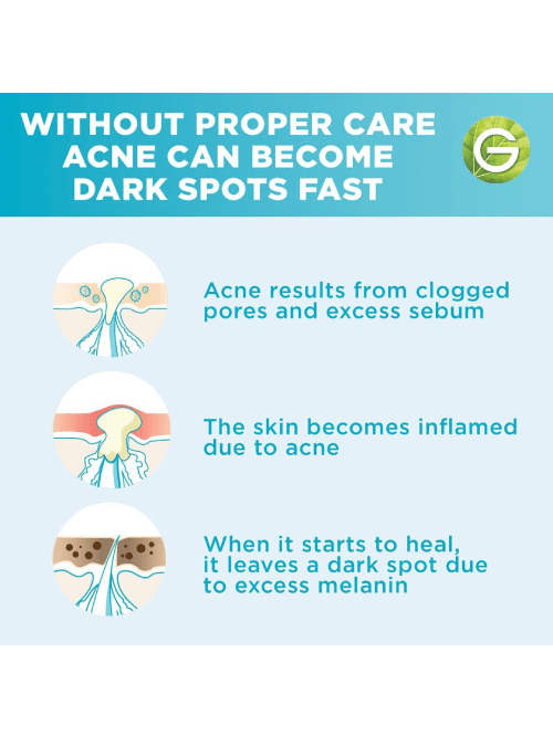 Fast Clear Booster Serum with Salicylic Acid • Garnier Arabia